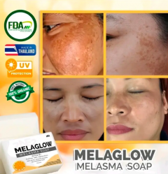 2NE2 Thailand MelaGlow Melasma Soap (100g) - Melasma Pekas, Hyperpigmentation at Dark Spots Skin Repair Skin Care Acne
